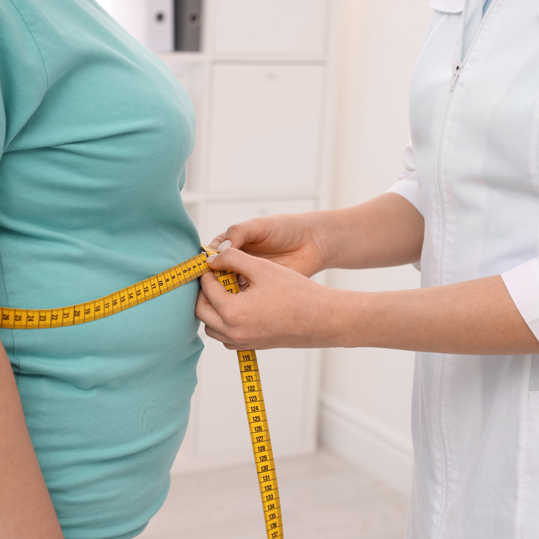 Otyłość - wpływ na zdrowie, rodzaje i leczenie Otyłość - wpływ na zdrowie, rodzaje i leczenie