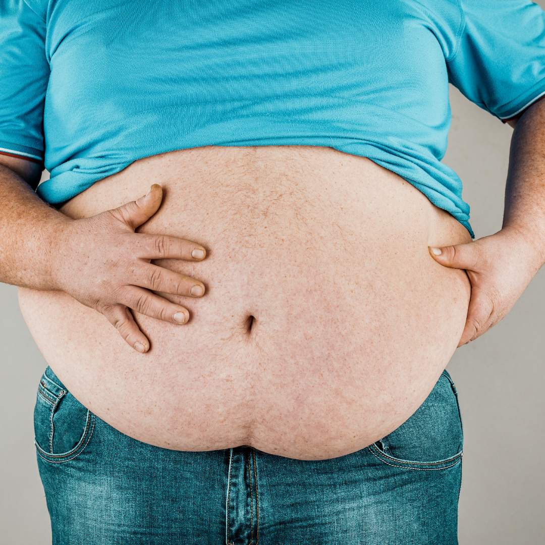 otyłość brzuszna