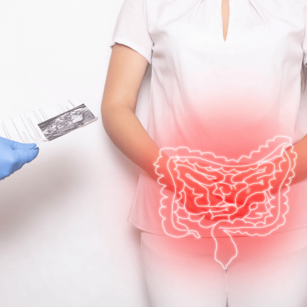 Zespół jelita drażliwego – co jeść i jaką dietę stosować?