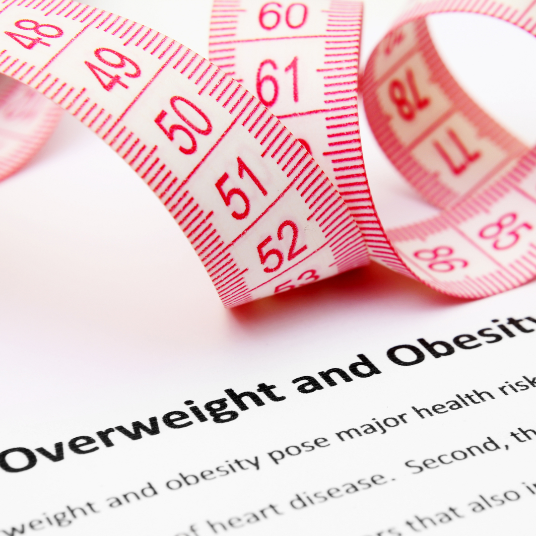 Otyłość olbrzymia - czym jest i jak ją leczyć?