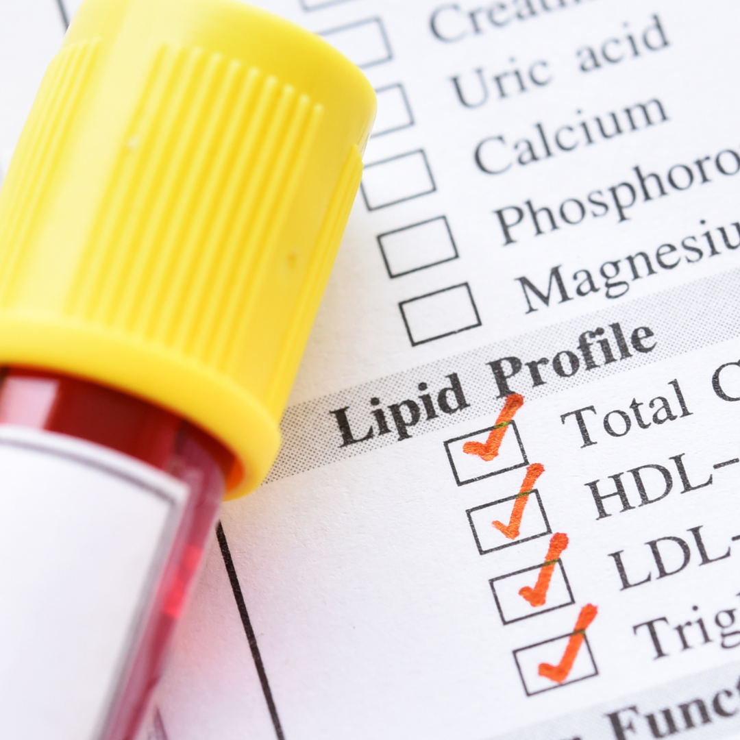 Co to jest lipidogram? Przygotowanie do badania, frakcje cholesterolu